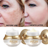 AILKE Women Whitening Face Care Set, Lightening, Reduce Dark Spots, Anti Wrinkles, For All Skin Types, Not Greasy, Easy Absorb