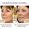 AILKE Whitening Dark Spots Remove Facial Skin Care Cream With Collagen, Reduce Freckles, Wrinkles, Women Premium Face Product
