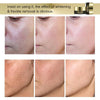 AILKE Whitening Face Cream, Reduce Dark Spots, Wrinkles, Melanin, Even Skin Tone, With Collagen, Glutathione, for All Skin Types