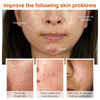 Effective Whitening Serum Remove Dark Spots Freckle Essence Anti-Aging Fade Pigmentation Melasma Brighten Beauty Face Skin Care