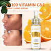 AILKE Lightening Body Cream, With Vitamin C, Hyaluronic Acid, Shea Butter, Reduce Black Spots, Even Skin Tone, Hydration Lotion